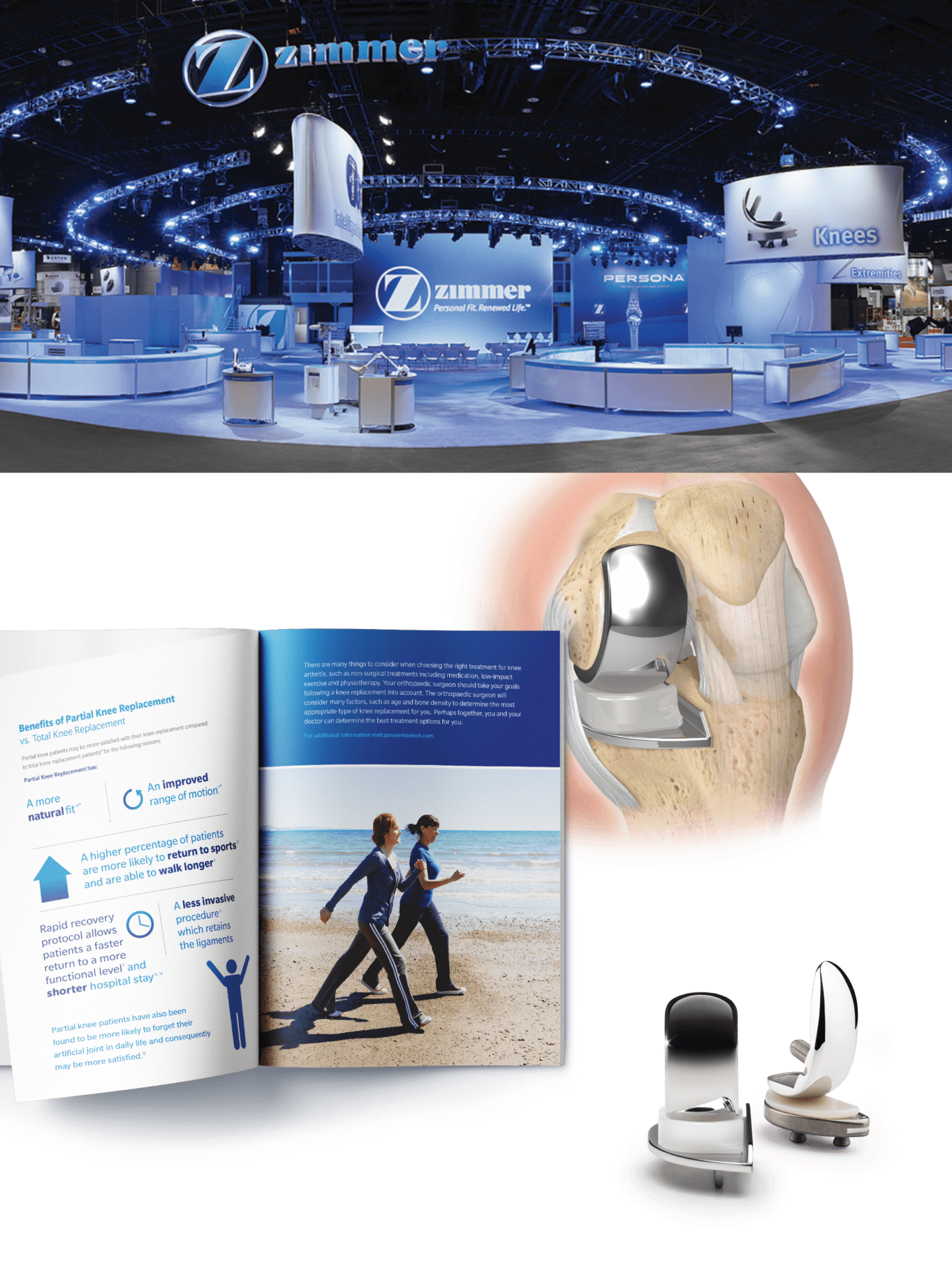 Zimmer Biomet Case Study Ferguson