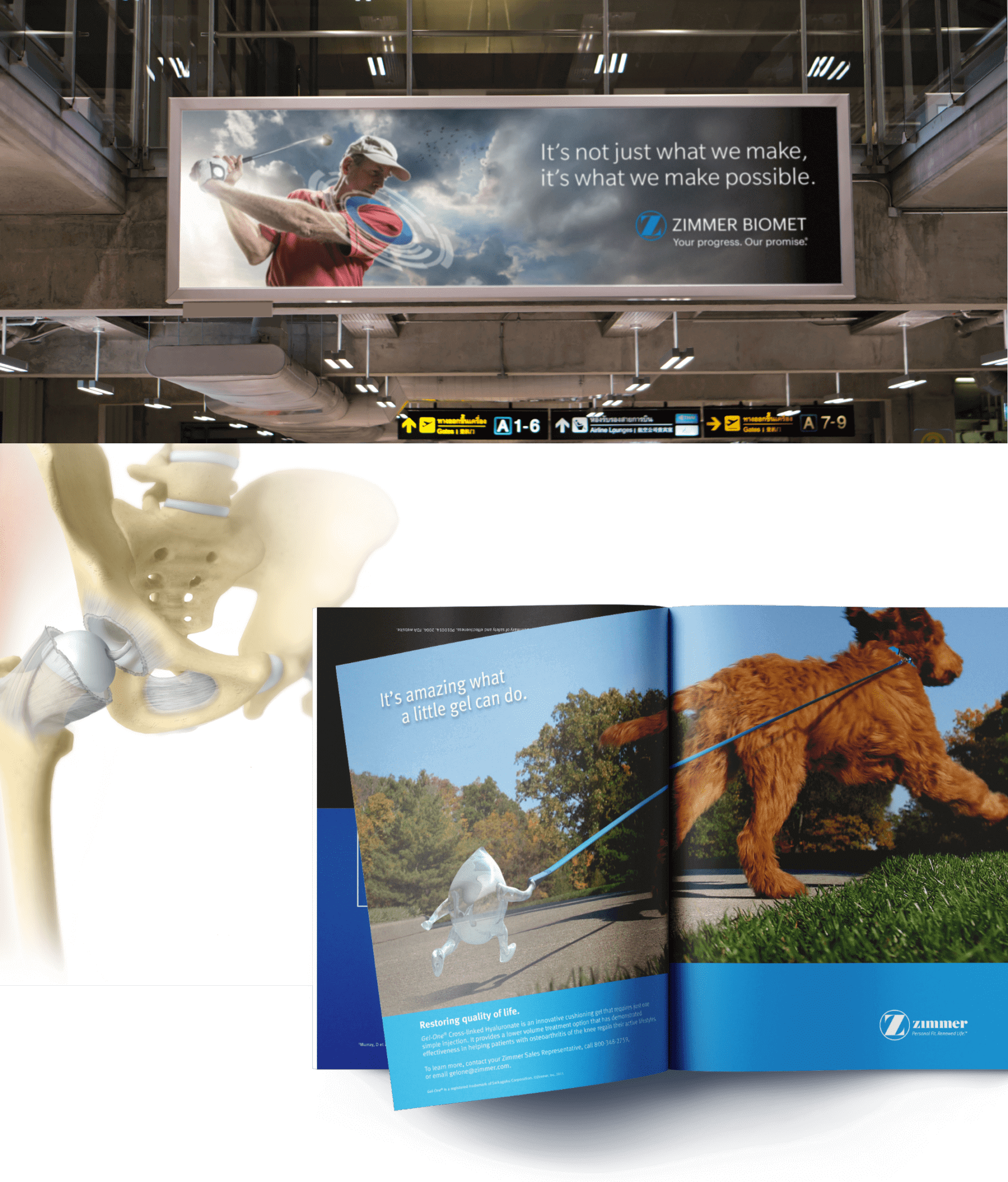 Zimmer Biomet Case Study Ferguson